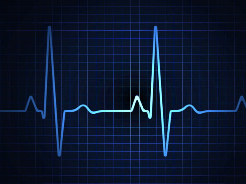 Excelling in EKG Practice: Tips for Improved Performance
